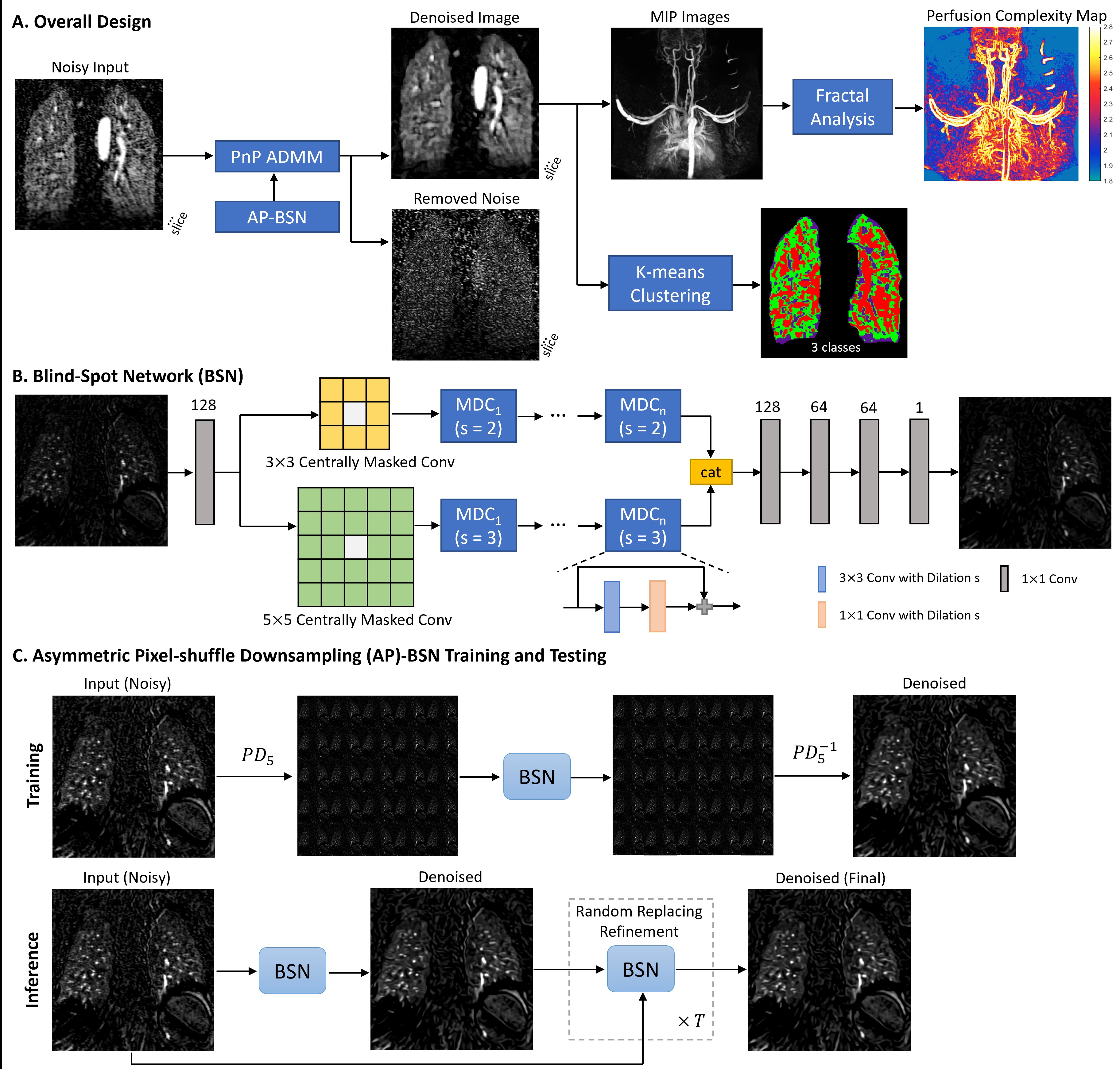 Plug-and-Play Self-Supervised Denoising